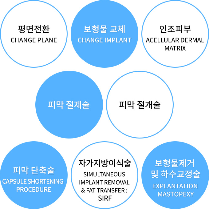 가슴재수술의 방법