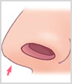 수술방법5