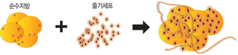 줄기세포 지방이식